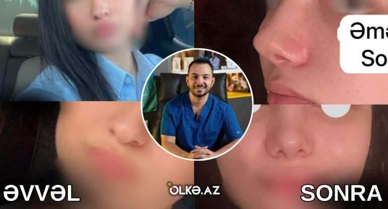 Həkimlə pasiyent arasında mübahisə: Kim haqlıdır? - Foto