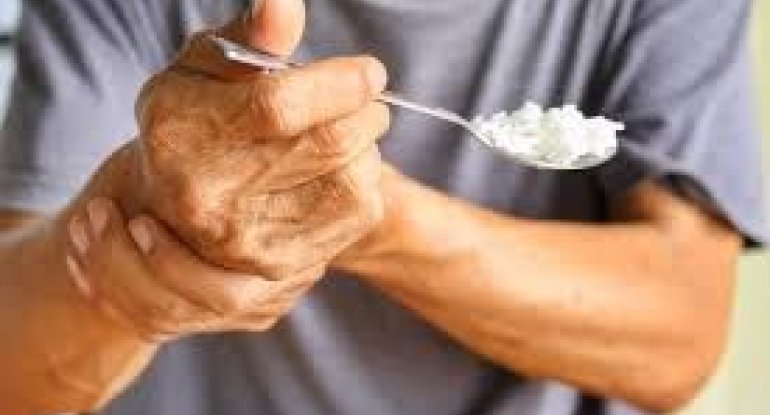 Parkinson xəstəliyinin gözlərdə görünən əlaməti