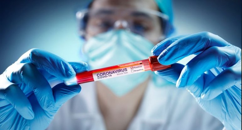 Bakıda koronavirus yayılıb? - Tibbi ekspert açıqladı