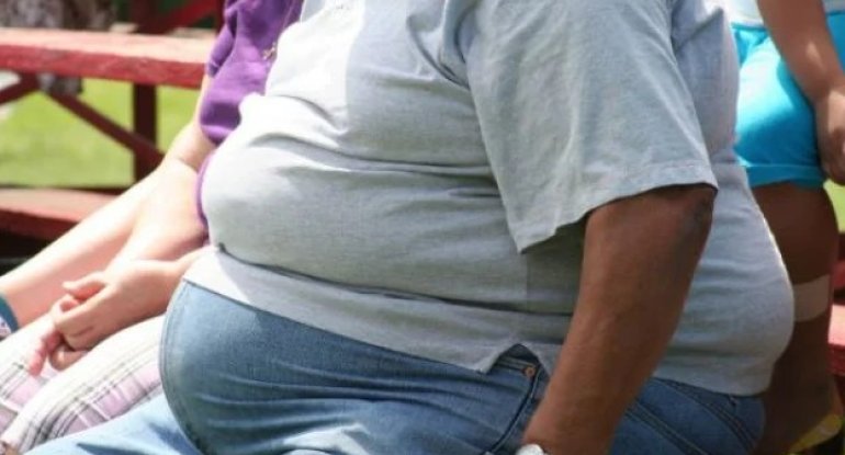 2030-cu ilə qədər yarım milyard yeniyetmə obez olacaq