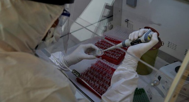 Fəlakət gəlir: "COVID-19"dan da betər virus aşkarlandı