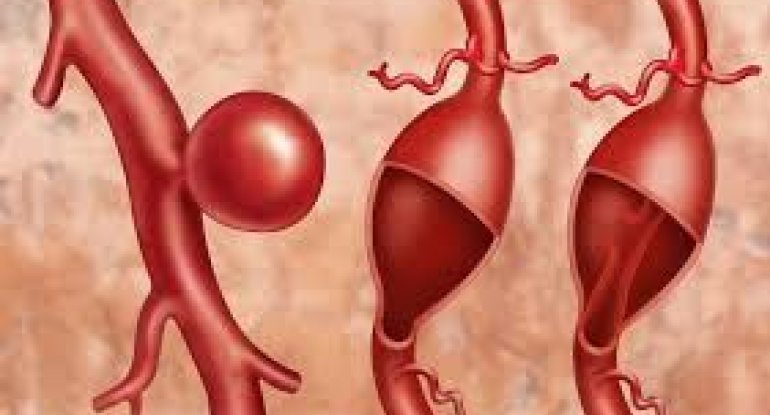 Hansı vitaminin əskikliyi damarları nazildir?