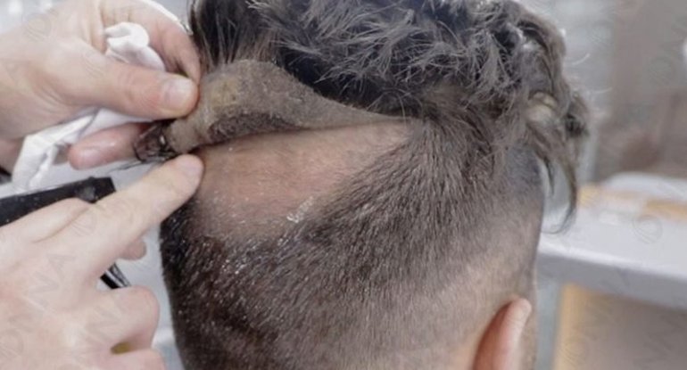 Bərbərxanadan 60 protez saç oğurlandı - "TikTok"da üstü açıldı
