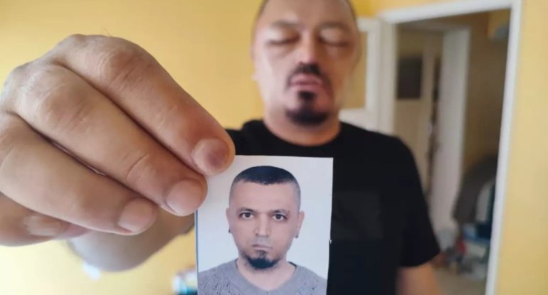 Saçlarını qaraltmaq üçün aldığı şampun həyatını kabusa çevirdi - Foto