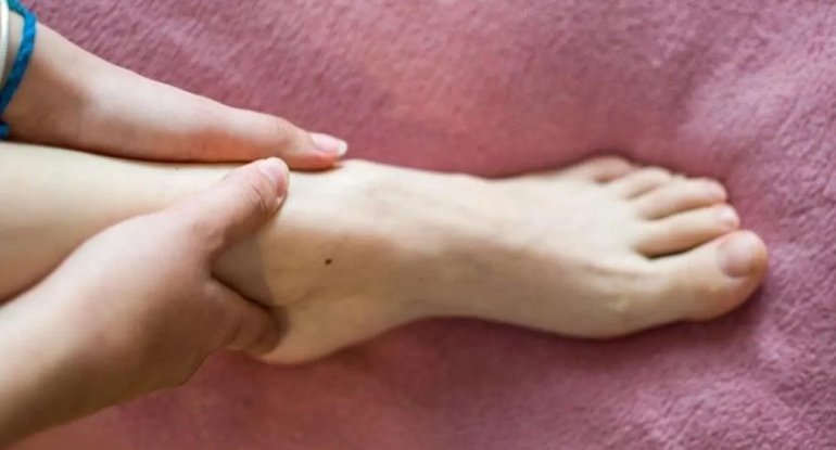 Ürək çatışmazlığının az bilinən əlaməti: Ayaq biləklərində görünür