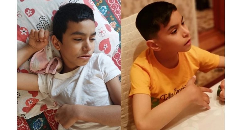 13 yaşlı İbrahimin dəstəyinizə ehtiyacı var - FOTO