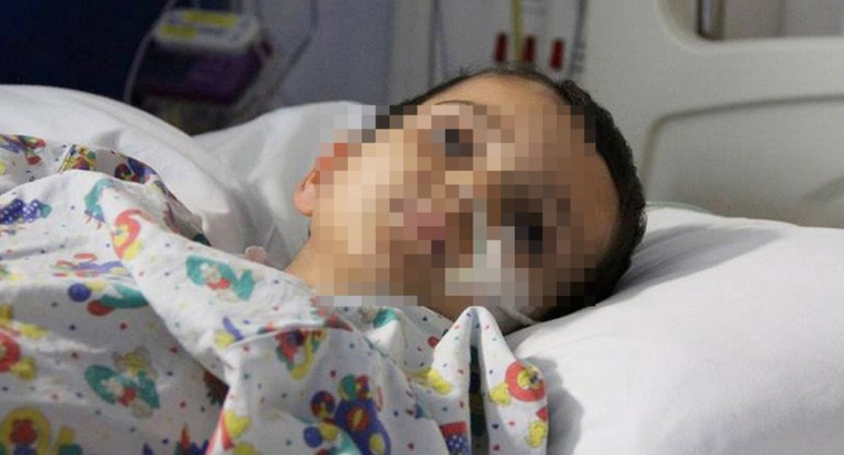 Quduzluqdan ölən uşaqla bağlı rəsmi açıqlama