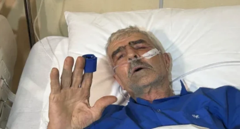 Təyyarə qəzasında yaralanan Zaqatala sakini&nbsp;vəfat etdi