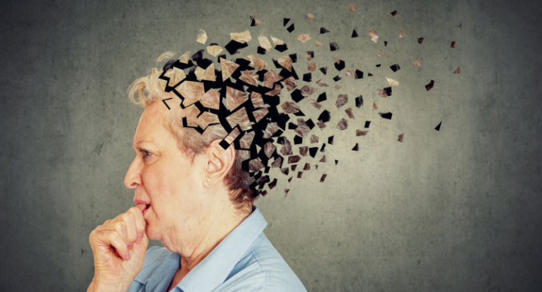 Gündə 5000 addım alzheimer xəstəliyindən qorumağa kömək edə bilər