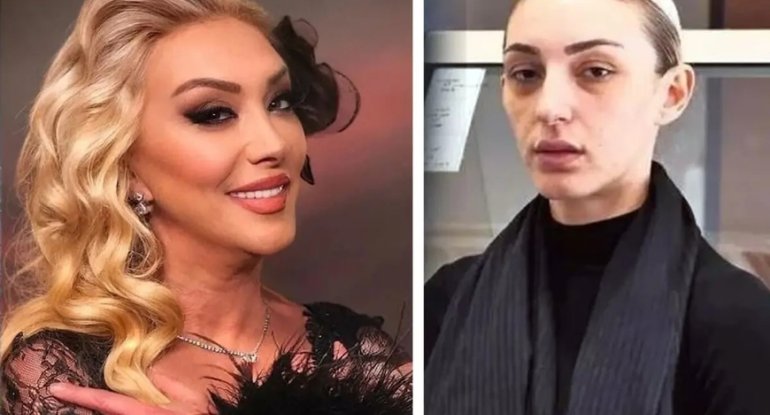 Faciəvi şəkildə ölən 52 yaşlı müğənninin qızından ŞOK paylaşım - FOTO