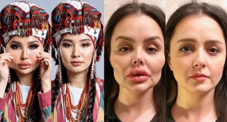 Süni gözəlliyə etiraz: Qazaxların başlatdığı trend dünyanı bürüdü - VİDEO
