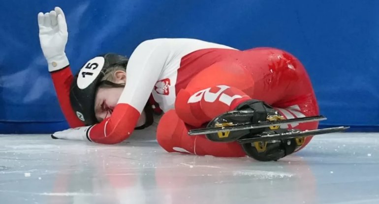 Konkinin bıçağı gözünü kor etmişdi: Olimpiadadan çıxarıldı - FOTOLAR