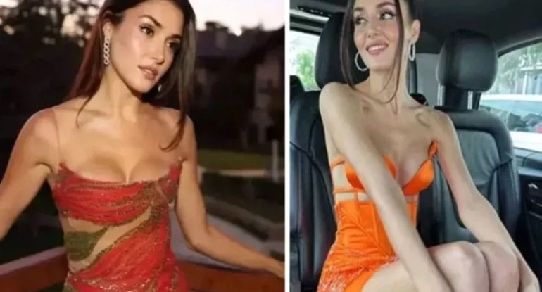 Hande Erçelin test nəticəsi açıqlanıb