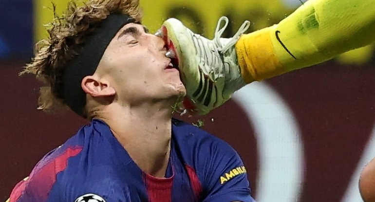 "Barselona"nın futbolçusu az qala canından olacaqdı - FOTO