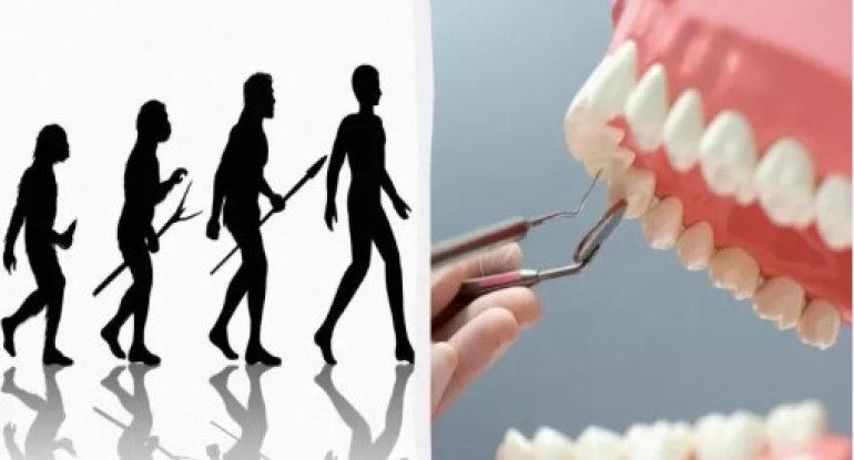 Ağıl dişlərinin zəka ilə əlaqəsi - Onlar nə üçün lazımdır?