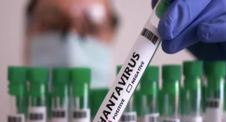 Dünyanı təşvişə salan Hantavirus nədir? - ƏLAMƏTLƏRİ
