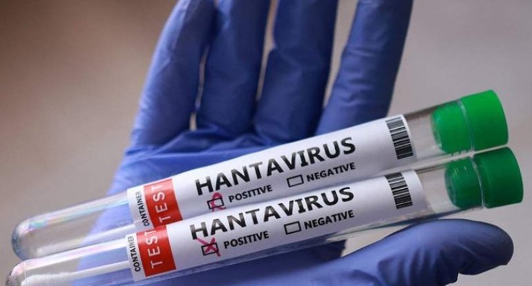 Azərbaycanda hantavirusa yoluxma qeydə alınıb? -