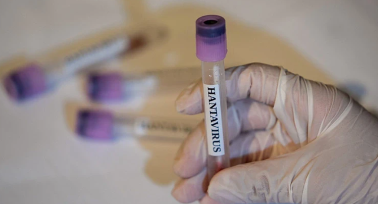 Daha bir ölkədə hantavirus təhlükəsi