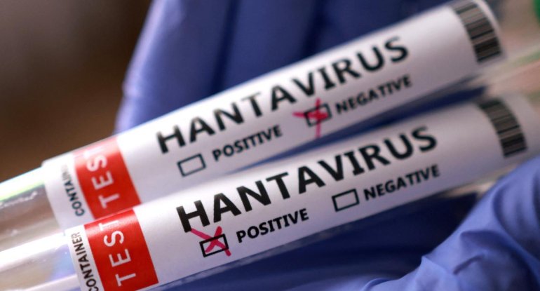 ÜST hantavirus ilə bağlı xəbərdarlıq edib