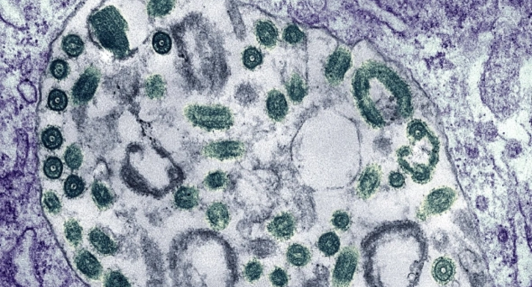 Evi təmizləyəndə çıxan toz da hantavirus yarada bilər