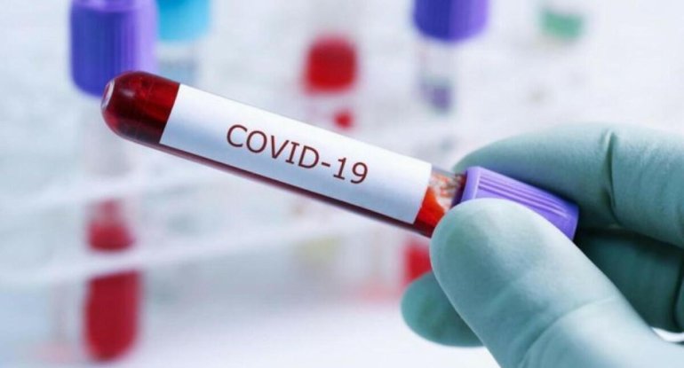 COVID-19-dan ölənlərin sayı 7 milyonu keçdi