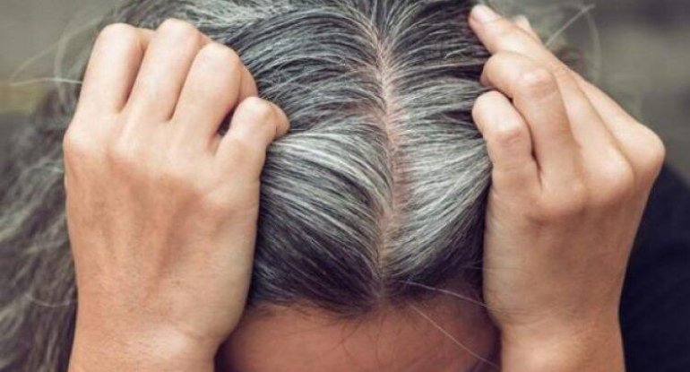 Alimlərdən yeni kəşf: Ağ saçlar xərçəngdən qoruyur