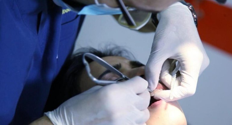 Dələduzluğa görə həbsdə olan stomatoloqun daha bir cinayəti üzə çıxdı