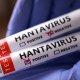 Hantavirusdan öldükləri təsdiqləndi Hantavirusdan öldükləri təsdiqləndi