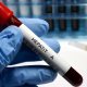 Azərbaycanda hepatitə yoluxanların sayı açıqlandı Azərbaycanda hepatitə yoluxanların sayı açıqlandı
